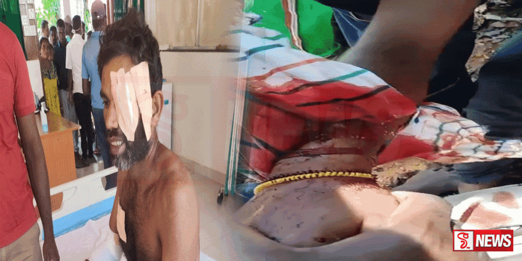 වතු කම්කරුවෙකුට කොටි ප්රහාරයක්