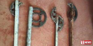 මැරකල්ලි විසින් භාවිතා කරන තියුණු ආයුධ කිහිපයක් හමුවේ