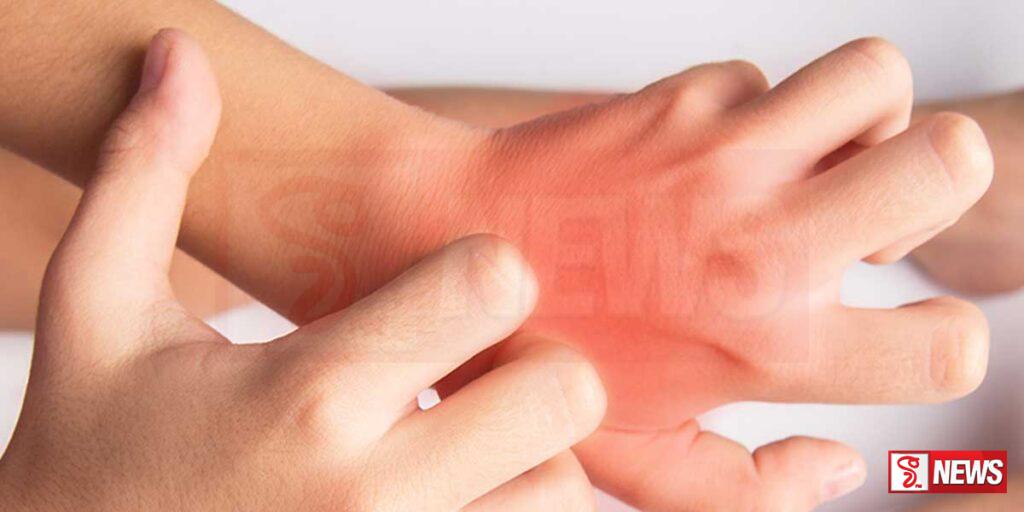 ළමුන් අතර සමේ රෝග ව්යාප්තවීමේ අවදානමක්