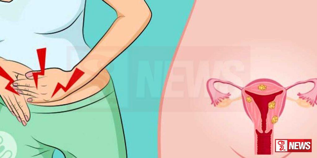 ගැබ්ගෙල පිලිකා නිසා සිදුවන මරණ සංඛ්යාව අඩු කිරීමට අපේක්ෂා