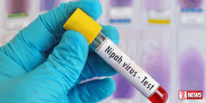 නිපා පරීක්ෂණ කට්ටල ඉදිරි දිනවලදී දිවයිනට