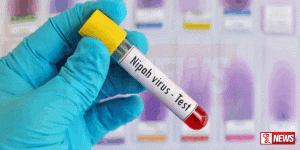 නිපා වයිරසයට මුහුණදීමට සූදානම්