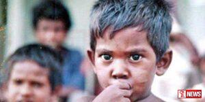 අවුරුදු 05 ට අඩු දරුවන් අතර උග්ර මන්දපෝෂණ තත්ත්වයක්