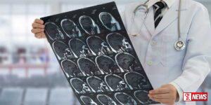 අඝාතය වැළදුනු රෝගීන් වාර්තා වීමේ වැඩිවීමක්