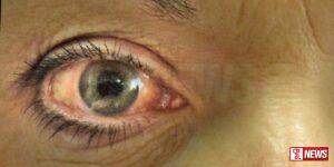 වයස 50 ට වැඩිද? – දැන්ම ඇස් පරික්ෂා කරගන්න