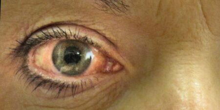 වයස 50 ට වැඩිද? – දැන්ම ඇස් පරික්ෂා කරගන්න