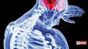 බිලියන 03කට අධික පිරිසක් ස්නායු අබාධ වලට ගොදුරු වෙයි