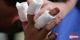 ගිනිකෙළි අනතුරුවලින් ප්රවේශම් වන්න