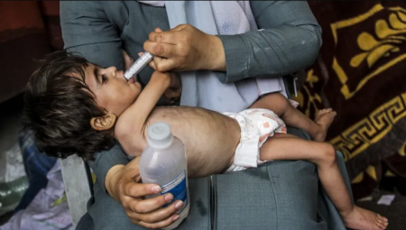 ඊශ්රායල-හමාස් යුධ ගැටුම් හමුවේ ගාසා තීරයේ ළමුන් 8,000ක් උග්ර මන්දපෝෂණයට ගොදුරු වෙයි