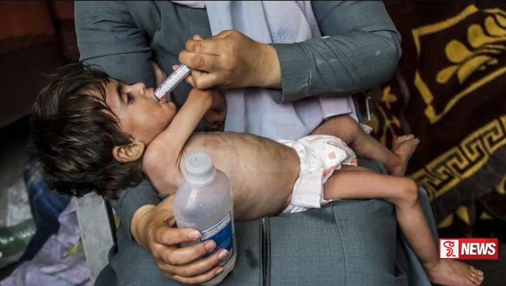 ඊශ්රායල-හමාස් යුධ ගැටුම් හමුවේ ගාසා තීරයේ ළමුන් 8,000ක් උග්ර මන්දපෝෂණයට ගොදුරු වෙයි