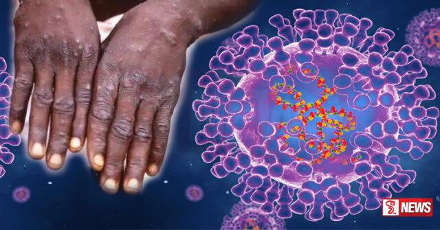 වඳුරු උණ වැළඳීමෙන් මරණ 548 ක්