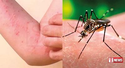 ඩෙංගු සහ චිකුන්ගුන්යා රෝගීන්ගේ වැඩි වීමක්