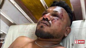 බිහිසුණු ගුවන් අනතුරෙන් එක් මගියෙකු දිවි බේරාගයි