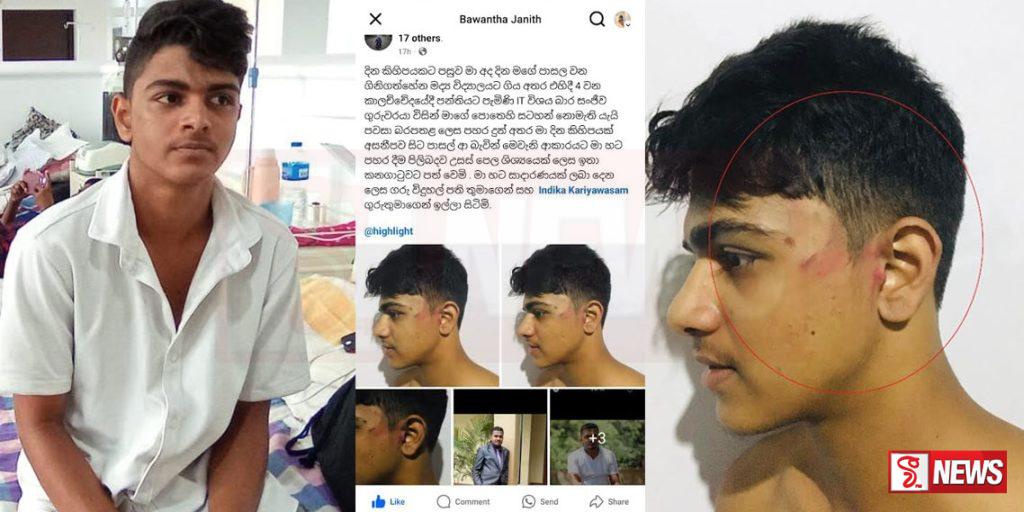 VIDEO : ගිනිගත්හේන ජාතික පාසලේ තාක්ෂණ සිසුවාට කණේ පාරක්