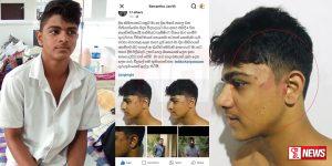 VIDEO : ගිනිගත්හේන ජාතික පාසලේ තාක්ෂණ සිසුවාට කණේ පාරක්