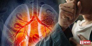 පිරිමින්ට පෙනහළු පිළිකා අවදානමක්