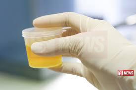 රියදුරන්ගේ මත්ද්රව්ය භාවිතය පිලිබද අහඹු පරීක්ෂණයක්