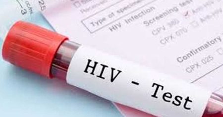 පාකිස්ථානයේ ඒඩ්ස් රෝගය ඉහළට