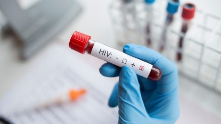 HIV රෝගීන් සංඛ්යාව ඉහළට